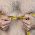 How Severe Gynecomastia Affects Men’s Mental Health